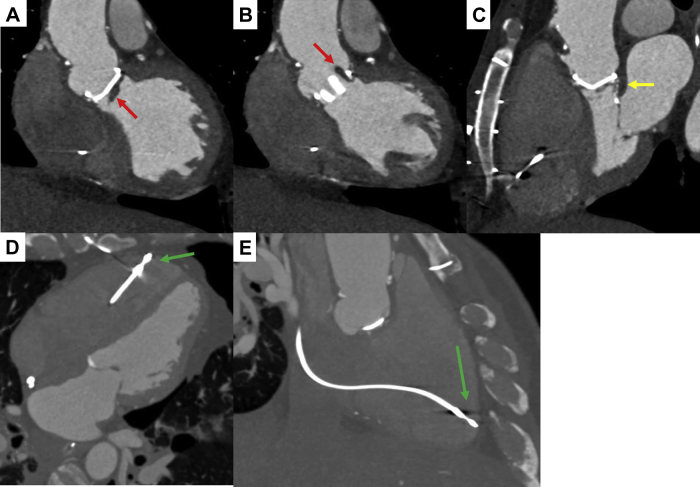 Figure 3