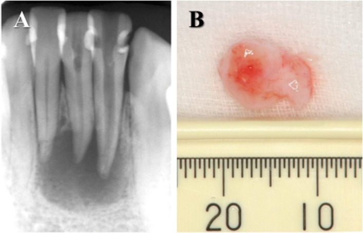 Fig 1