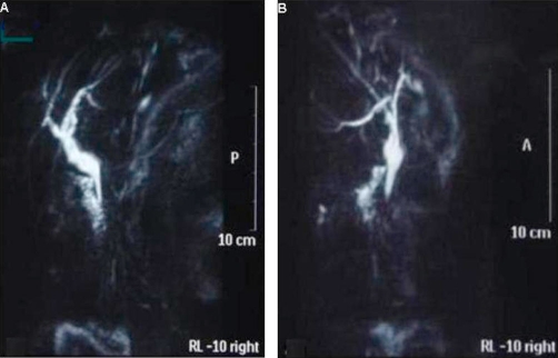 Figure 2A and B.