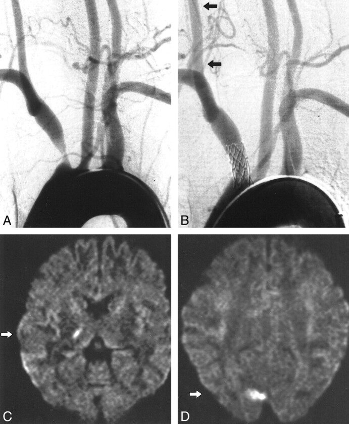 fig 2.