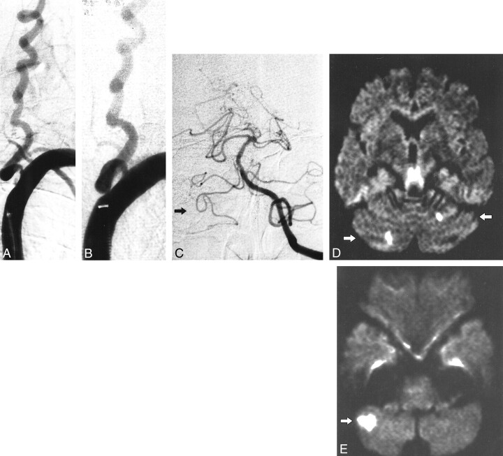 fig 3.