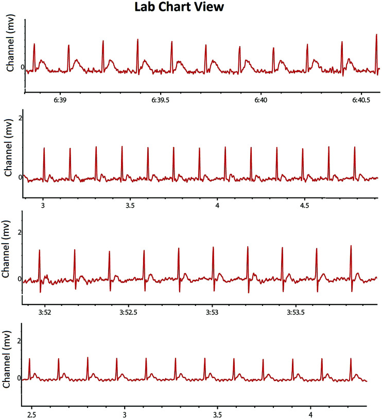 Fig. 4