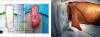 Figure 3-4