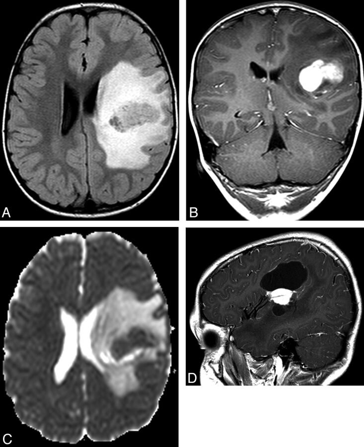 Fig 2.