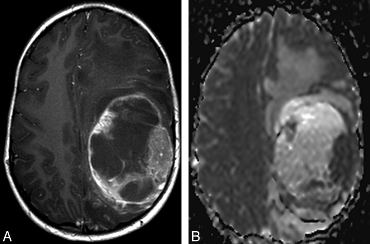 Fig 3.