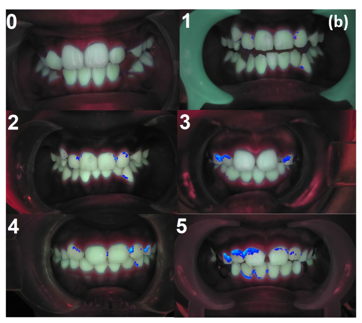 Figure 5