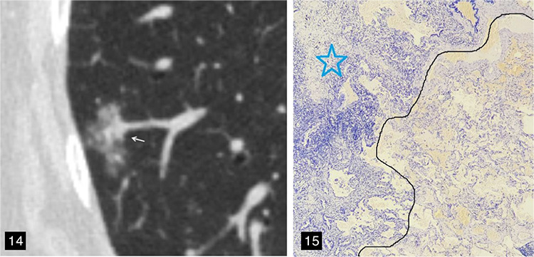 Figure 14-15