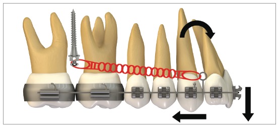 Figure 24