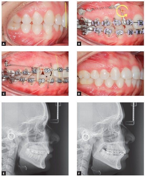 Figure 29