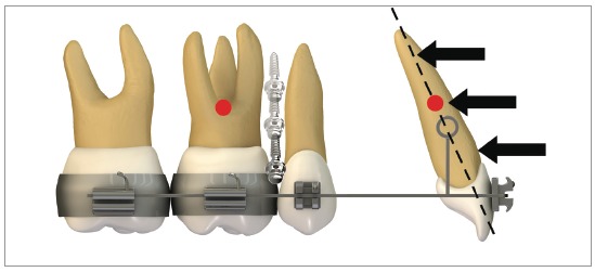 Figure 22