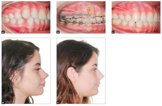 Figure 25