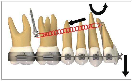 Figure 28