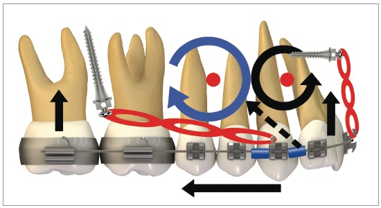 Figure 30