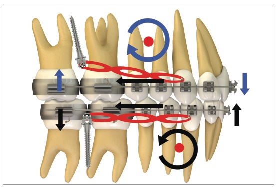 Figure 20