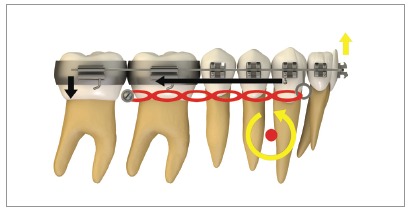 Figure 16