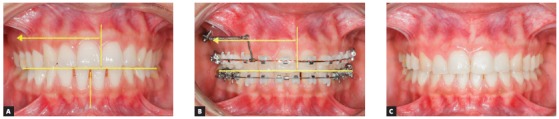 Figure 23