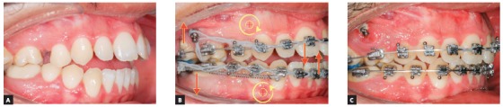 Figure 21