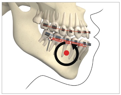 Figure 14