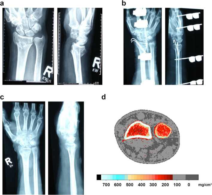 Fig. 1