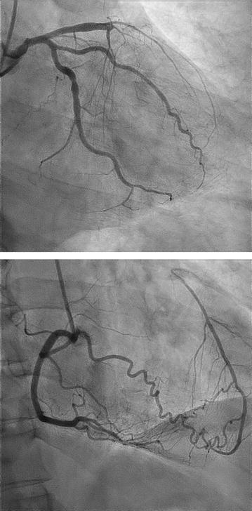 Fig. 1