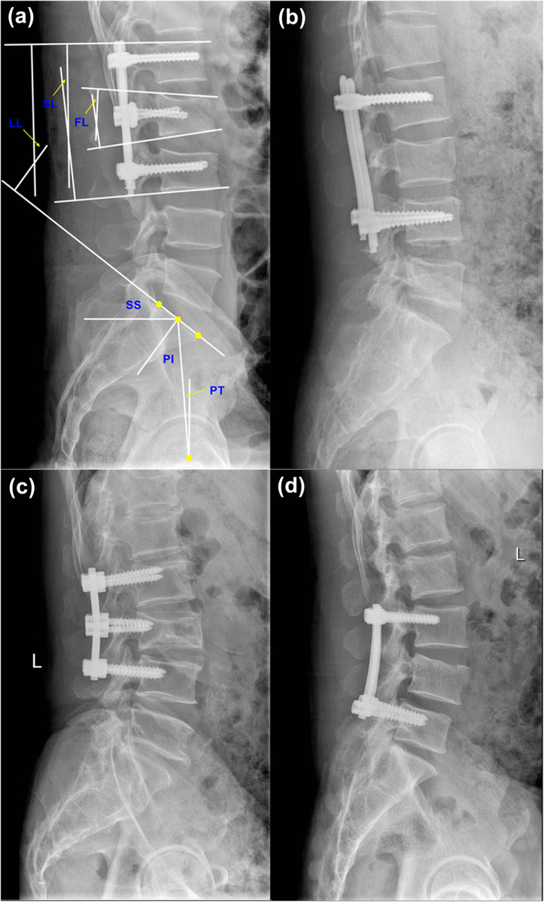 Fig. 1