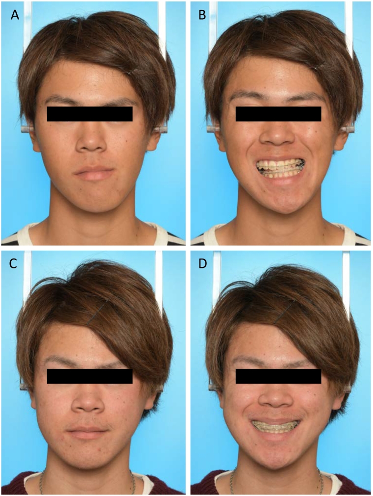 Fig. 3