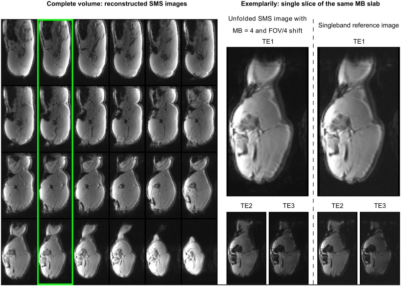 Fig 4