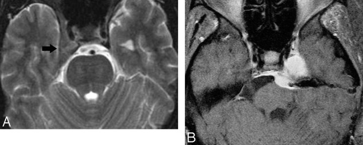 Fig 5.