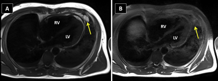 Figure 4