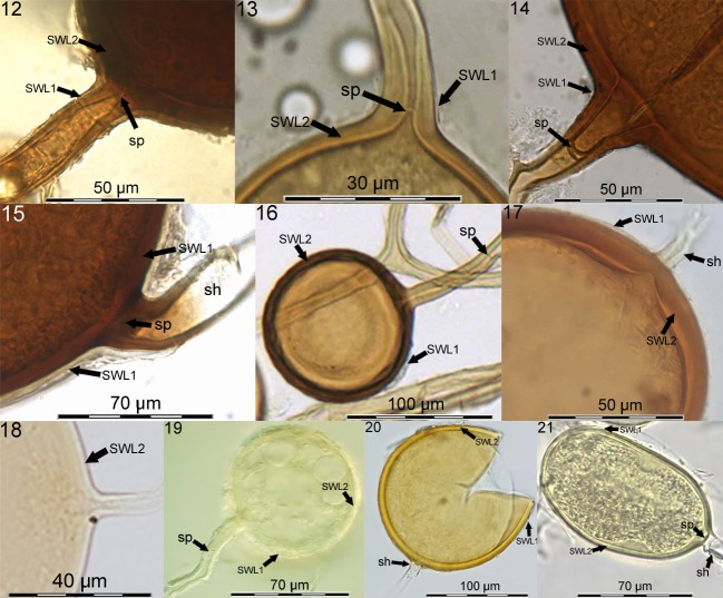 Advances in Glomeromycota taxonomy and classification - PMC