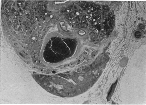 FIG. 21.