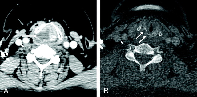 Fig 1.