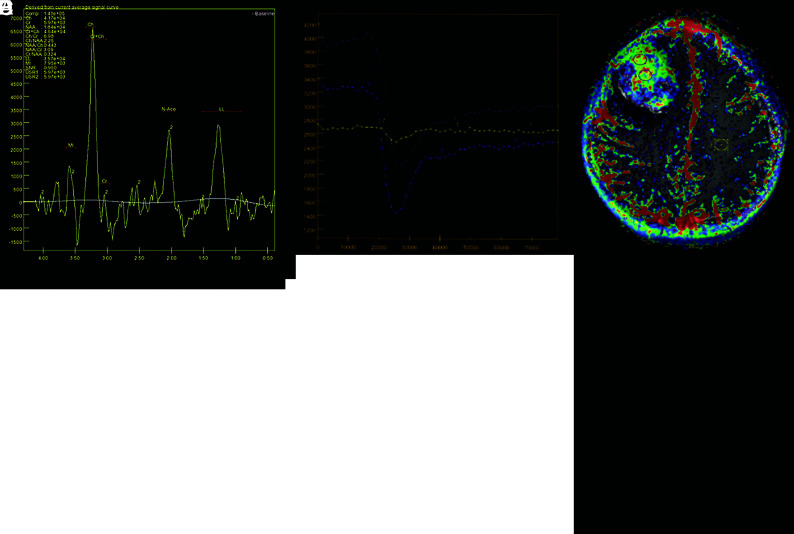 FIG 2.