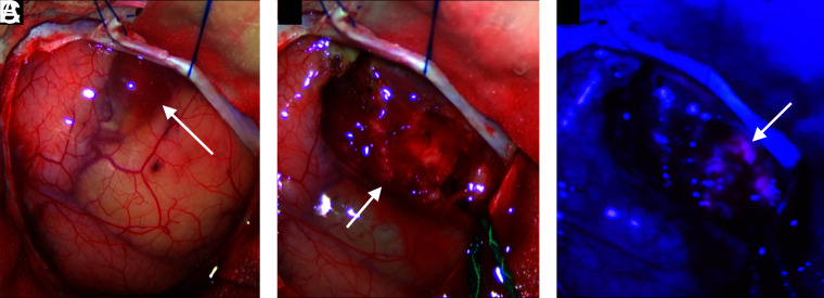 FIG 3.