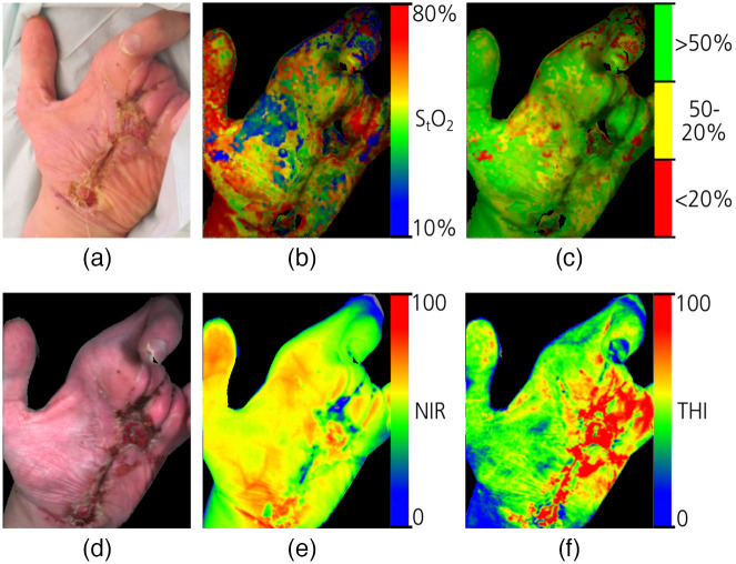 Fig. 13