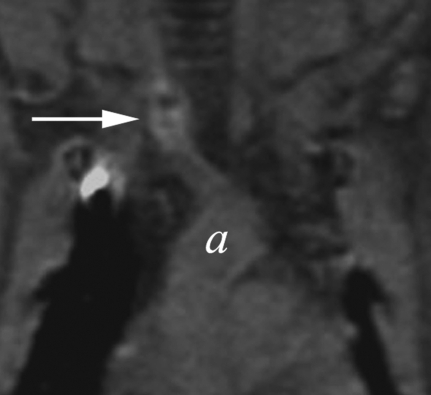 Figure 4c: