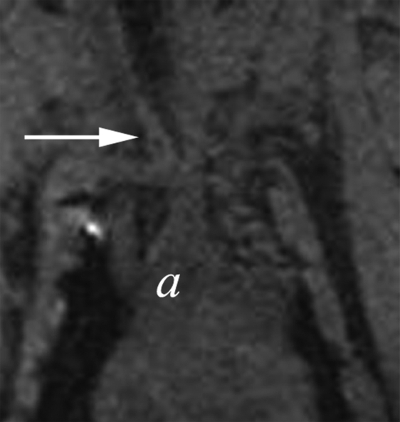 Figure 4a: