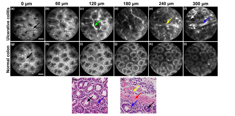 Fig. 11