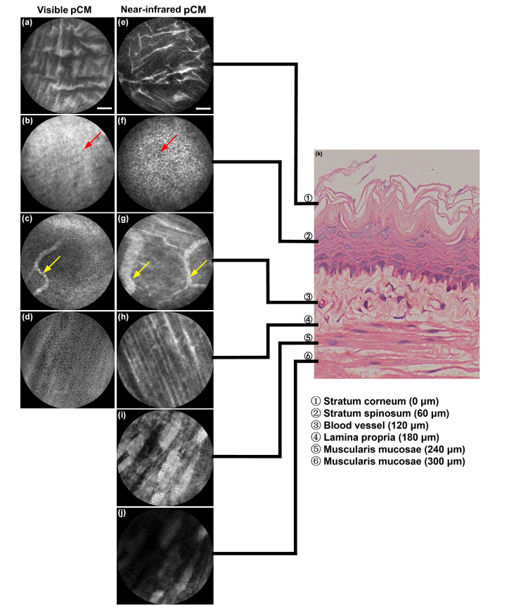 Fig. 10