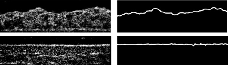 Fig. 13