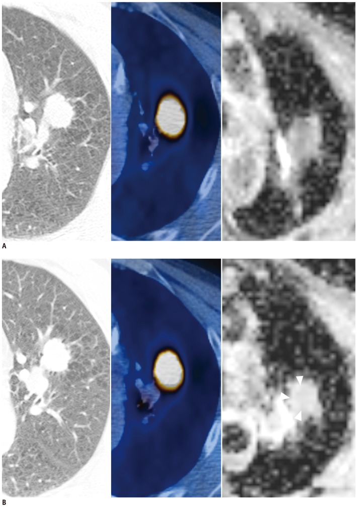 Fig. 11