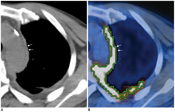 Fig. 9