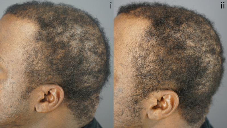 Fig. 12