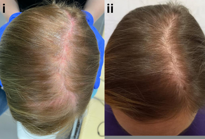 Fig. 8