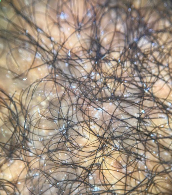 Fig. 10