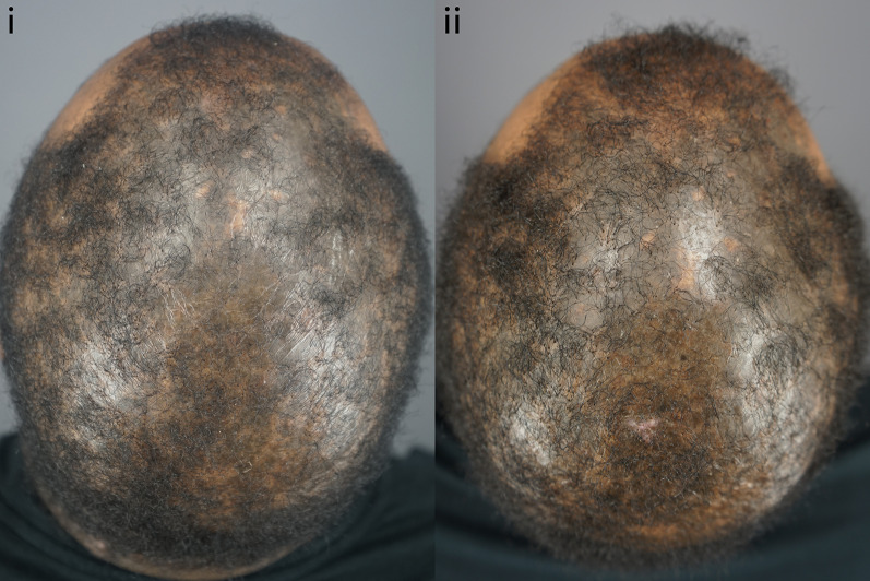 Fig. 11