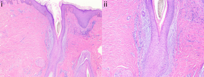 Fig. 13