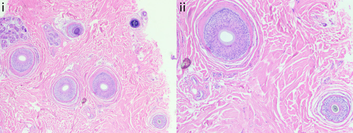 Fig. 14