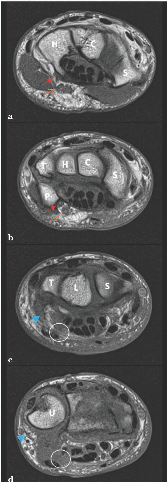 Figure 2A to 2D.