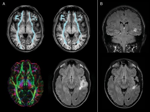 Fig. 2.